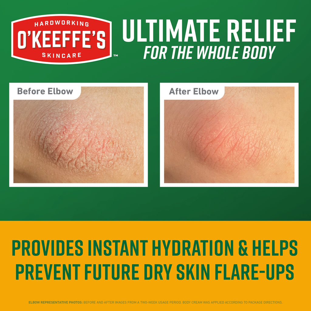 O’Keeffe’s Skin Repair Body Cream, Ultimate Relief, 48 Hour Moisture, Unscented, 7oz Tube